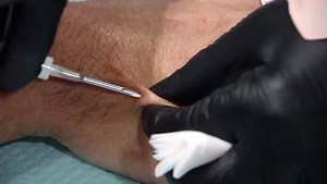 WOULD YOU DO IT? MICROCHIPPED: Dozens of employees at a Wisconsin tech company have now been microchipped! 41 workers for the “Three Square Market” had the microchip put into their hand or arm yesterday. The chip allows them to enter the building with a swipe of the hand, log into their computers and even buy snacks from a vending machine. What do you think? http://abc7.ws/2uv2WK1 | ABC 7 Chicago