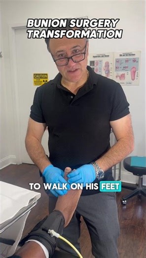 Bunion surgery transformation