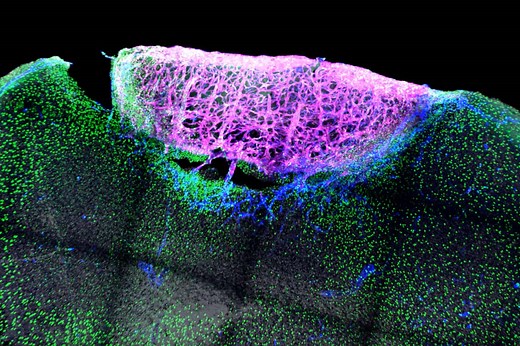 These Cells Have Hidden Powers That Could Heal Brain Injuries