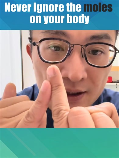 Small moles might cause big problem⚠ Ignoring it could come with some risks👉 #mole #moles #moleskine #melanoma #melanomaawareness #Cancer #cancerawareness #healthtips #chinahealthtrip #chinahealthcare #chinamedical #medicaltrip #medicaltravel #medicaltourism #medicaltourismchina #medicalservicechina #medicalservice #china