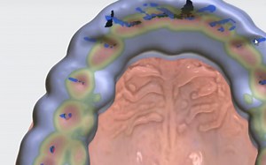 3shape咬合板设计，官方教程