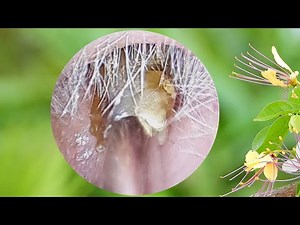 外耳道と耳垢で成長する白い真菌 耳真菌症としても知られる真菌感染症
