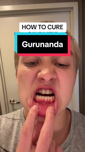 How to Cure Gingivitis: Effective Home Remedies