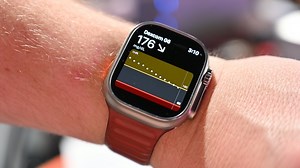 Hands on: Using Dexcom G7 CGM directly with Apple Watch