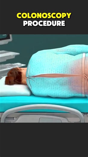 Colonoscopy procedure explained. It's not as scary as you imagine it to be.