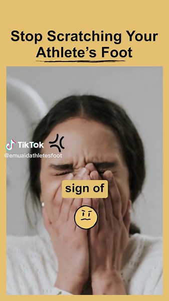 A natural solution for your athlete's foot problems. Don't waste your time on home remedies! Try EMUAIDMAX® for your athlete's foot fungus infection. Comes with a 30-day money-back guarantee. #emuaidworks #emuaidmaxathletesfoot #athletefoot #athletesfoot