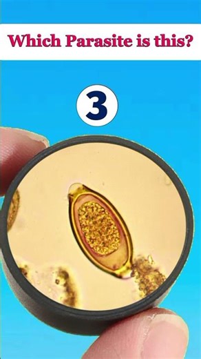 Can You Identify These Parasites? | Parasites Under the Microscope #parasitology