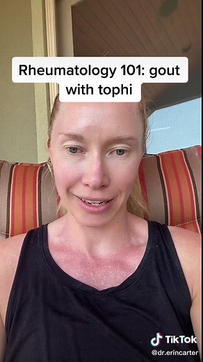 Understanding Gout with Tophi: Rheumatology Insights