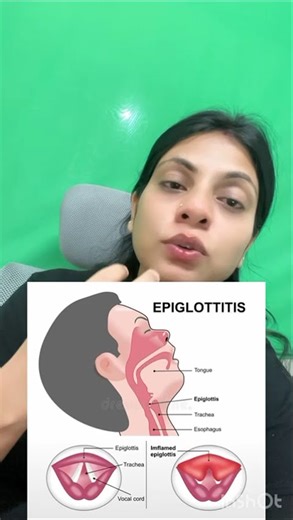 What is the Epiglottis? | Quick Anatomy Lesson on Swallowing