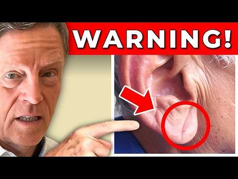 5 Silent Signs of Clogged Arteries You Should Never Ignore (Even if You Feel Fine)