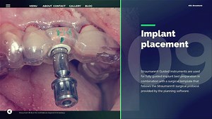 Straumann Guided Surgery Protocol💚 Step by step video by Prof. Sušić, Dr. Stojić & MDT I. Galić KOL Straumann Team Croatia | Straumann