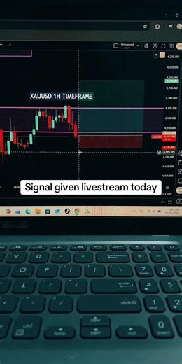 Forex Live Highlights: Today's Signal for XAU/USD