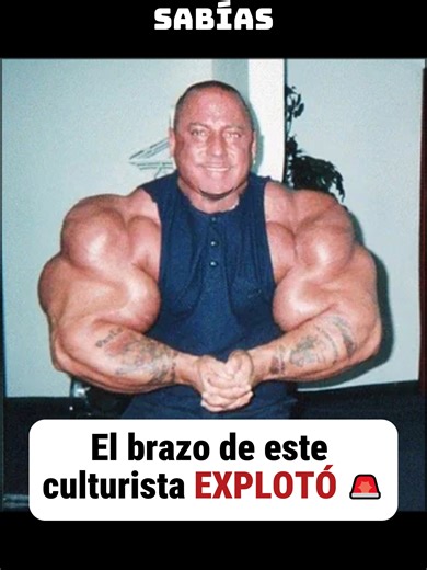 El riesgo del Synthol: La historia de Gregg Valentino
