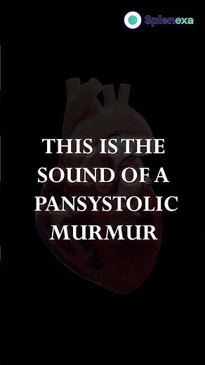 Pansystolic Murmur Made Easy