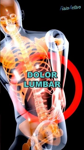 5 Ejercicios de Fisioterapia para el Dolor Lumbar Columna L5-S1