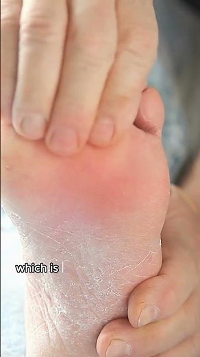 Understanding and Treating Ball of Foot Pain | Ankle & Foot Centers of America #footpain