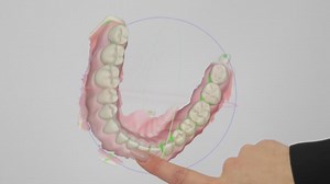 Digital Dental 3D Scan Visualization, Teeth Structure Displayed on Touchscreen