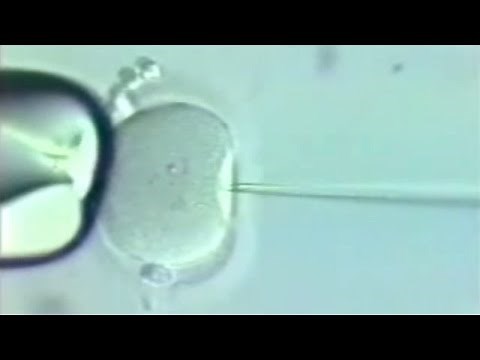 ART 4: ICSI (Infertility Treatment)