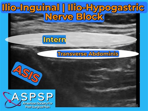 Illio-inguinal and Illio-hypogastric Nerve Block