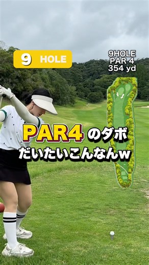 PAR4のダボだいたいこんなんw