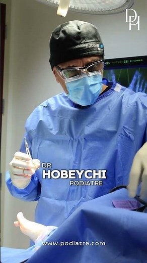 Chirurgie du Hallux Valgus : avant/après et correction complète | Dr Hobeychi, podiatre