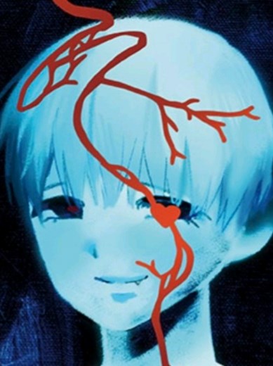 Luka's Alien Surgery Performance in Aliens Stage