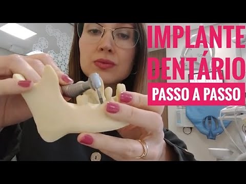 Dental Implant Step by Step l Dr. Danielle Sales