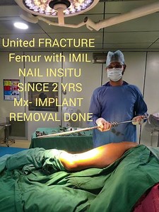 Implant Removal Done