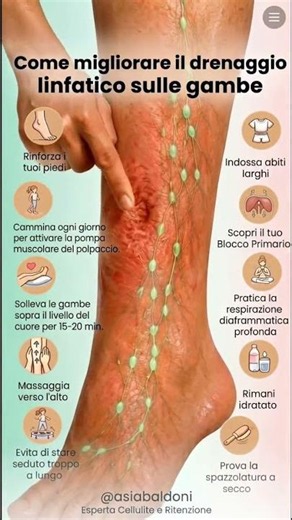 Se soffri di gambe pesanti e gonfie non sempre è colpa del grasso