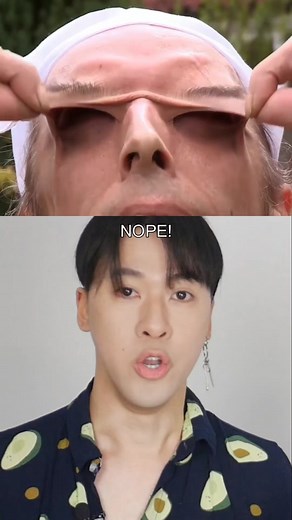 Rare Skin Condition: Stretchy Skin Explained