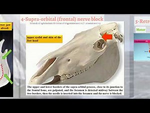 II-REGIONAL ANALGESIA I-PERI-NEURAL A-Regional Analgesia of Head 1-Horse 4-Supra-orbital (frontal)