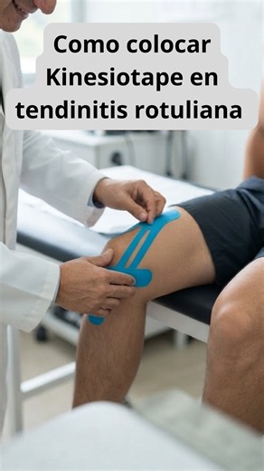 TENDINITIS ROTULIANA: CÓMO COLOCAR KINESIOTAPE