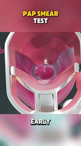 Pap smear test #medical #medical3danimation #medical3d #turp #pap #smear #smeartest #papsmear #papsmeartest #testsmear #smearpap | Mix Dancing Events