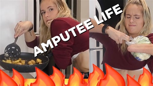 Amputee in the Kitchen Leads to FIRE?! You Won't Believe What Happened!