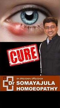 Eye Stye? Get Relief Fast With This Simple Home Remedies! Dr Somayajula
