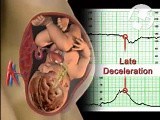 The Fetal Brain-Fetal Heart Relationship • Video • MEDtube.net