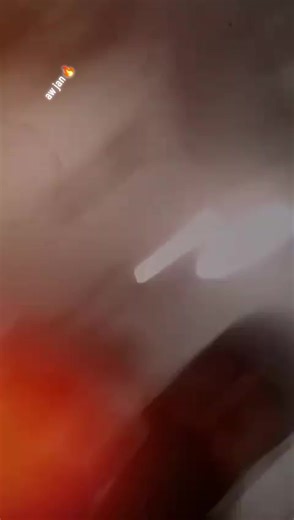 monga wafa lewne year da Cha na kao #myaccountunfreze🙏🥺 #plesse_support_me🙏🙏🙏 #viral?videotiktok😇😇 #doctor