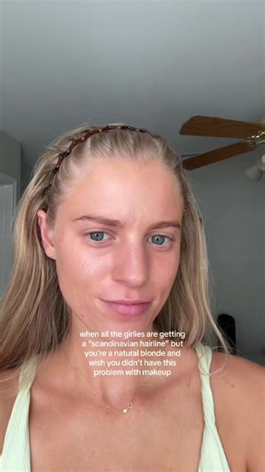 Natural Scandinavian Hairline and Blonde Features Explained