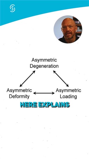 This graph shows the snowball effect of degenerative scoliosis. 📉 ​ Uneven disc and facet joint breakdown causes asymmetric loading, leading to further misalignment, increased joint stress, and accelerated degeneration. ​ Once this cycle starts, it tends to repeat unless the spine is actively stabilized and corrected. ​ This is why adult scoliosis rarely stays the same on its own. Want to know where your spine falls in this cycle? ​ Book a free discovery call with ScoliCare Denver. DM us or cli