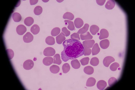 Monocytes hauts, bas : normes, rôle, interprétation du taux