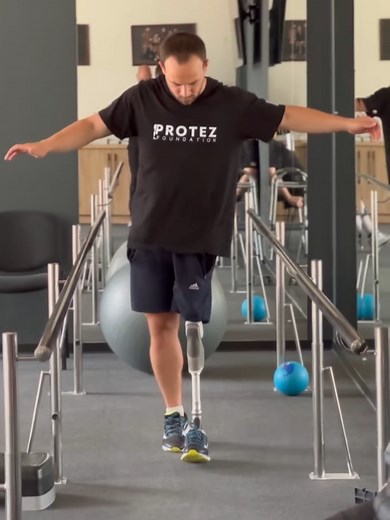 Understanding Hip Disarticulation in Prosthetics