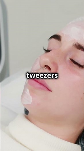 Removing skin tags with nail clippers