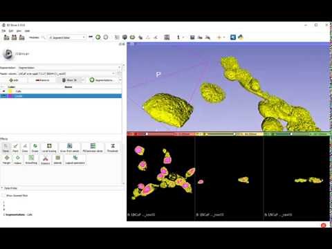 3D Slicer thresholding and segmentation