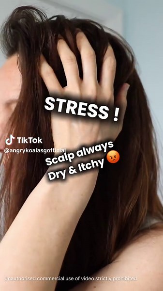 Scalp Relief Tips for Dandruff and Hair Loss