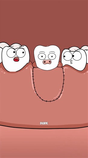 They Used a Cow Bone to Fix His Tooth. #shortsfeed