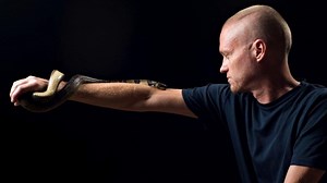 Wisconsin man's decades of snake bites spark groundbreaking research