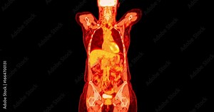Colorful PET scan whole body imaging highlighting brain, spinal cord and internal organs for radiology, nuclear medicine and medical research.