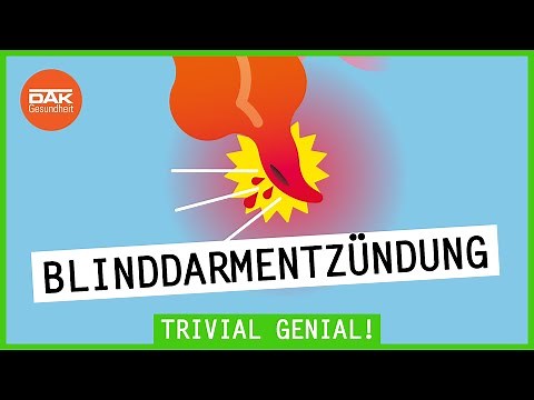 Blinddarmentzündung: Wie sie entsteht und du sie erkennst | Trivial Genial | DAK-Gesundheit