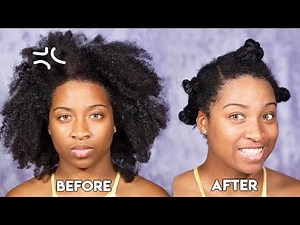 How To | Cure DRY/FLAKY Scalp On Coarse Type 4 Hair
