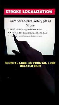 Stroke Localization : A brief Overview #physiotherapist #stroke